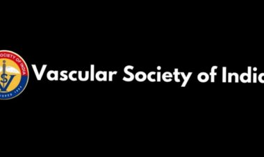 Varicose Veins - Treatment Options